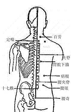 高血压按桥弓穴